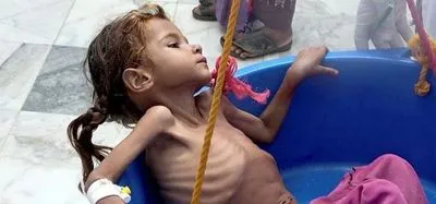 ЮНІСЕФ: понад 11 000 дітей було вбито або покалічено під час громадянської війни в Ємені