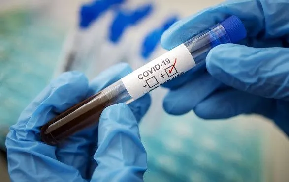 Количество больных коронавирусом в Украине каждую неделю увеличивается - Кузин