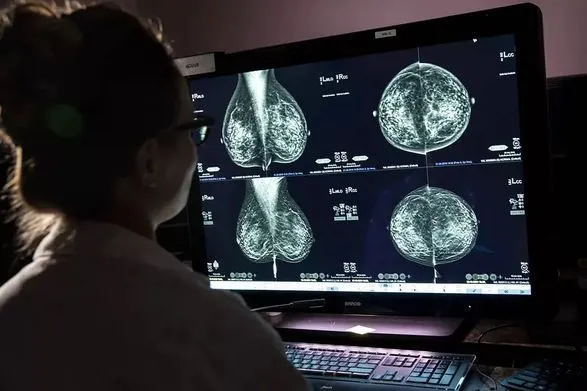 Група здоров'я США рекомендує жінкам проходити мамографію вже з 40 років