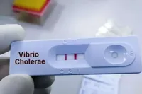 Підрив Каховської ГЕС: у чотирьох областях є близько 2 тис. тестів для діагностики холери