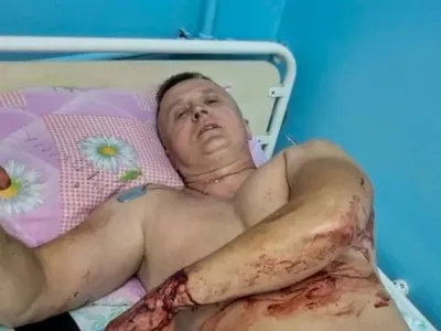 В Покровске под обстрел попал полицейский, герой фильма "20 дней в Мариуполе"