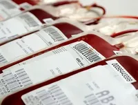 Донорскую кровь разрешат ввозить из-за границы в случае крайней необходимости  - Минздрав