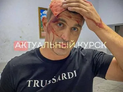У Маріуполі пропагандиста "руского міра" вдарили ломом по голові: підозрюють проукраїнських активістів