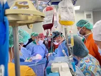 Первая сплит-трансплантация в Украине: медики рассказали детали уникальной операции