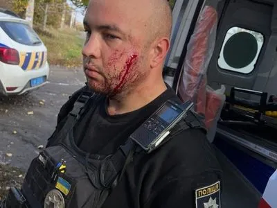 У Павлограді роздягнений чоловік напав з ножем на поліцейського