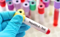 У Вінниці посилюють заходи проти поширення гепатиту А
