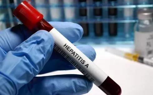 В Винницкой области количество случаев заболевания гепатитом A возросло до 280