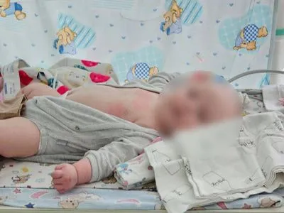 Обстрел машины под Херсоном: раненого младенца вместе с матерью переведут в Одессу