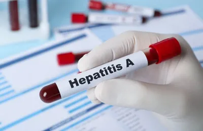 Hepatitis A outbreak in Vinnytsia region: waterborne infection is considered as one of the main versions