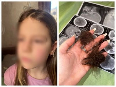  На Івано-Франківщині побили маму з її 6-річною донькою: поліція розпочала кримінальне провадження