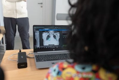 В Україні почнуть використовувати ШІ для діагностики туберкульозу