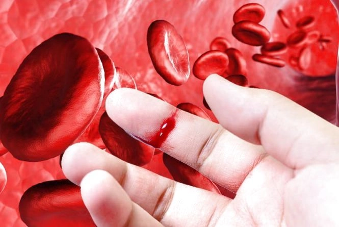 today-is-world-hemophilia-day-how-many-people-in-ukraine-suffer-from-this-incurable-disease