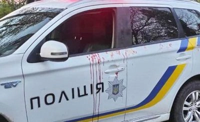 У лікарні розповіли про стан поліцейського, пораненого під час стрілянини у Вінницькій області