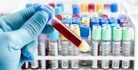 Medical breakthrough: blood test can show cancer risk in seven years