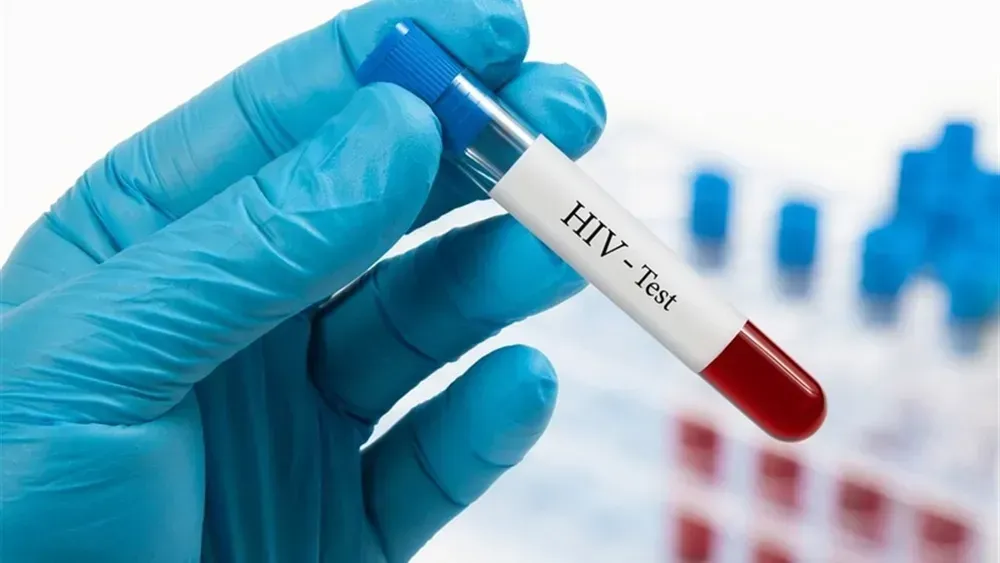 5percent-less-than-last-year-36-thousand-cases-of-hiv-and-758-cases-of-aids-were-registered-in-ukraine