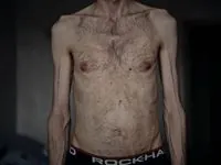 Lubinets shows what Ukrainian soldiers look like after Russian captivity