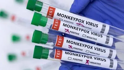 WHO declares monkeypox a global emergency