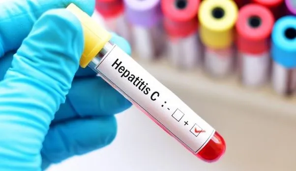 In one year, the number of prisoners with hepatitis C has tripled in Ukraine