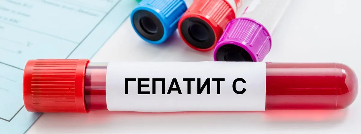 Infectious disease specialist Golubovskaya: due to the war, we are all at risk of hepatitis C infection