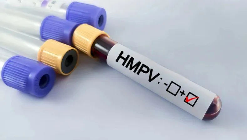 One case of metapneumovirus has been recorded in Kyiv: what you need to know about HMPV