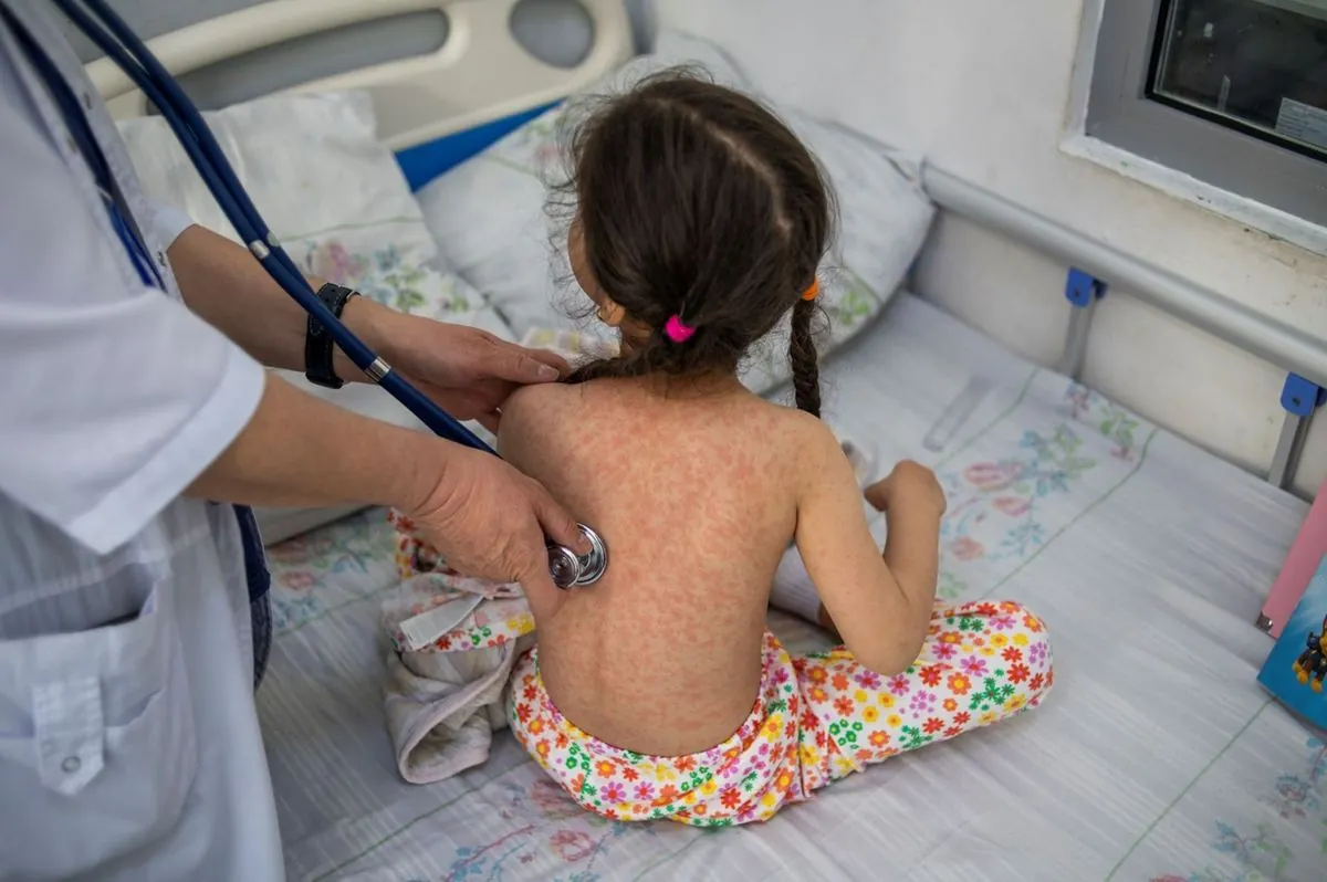 Measles in Europe: WHO reports doubling of cases amid vaccination decline after COVID