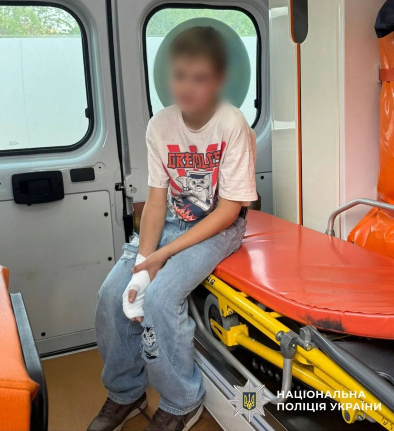 Приніс додому невідомі елементи живлення: під Києвом постраждав підліток Приніс додому невідомі елементи живлення: під Києвом постраждав підліток