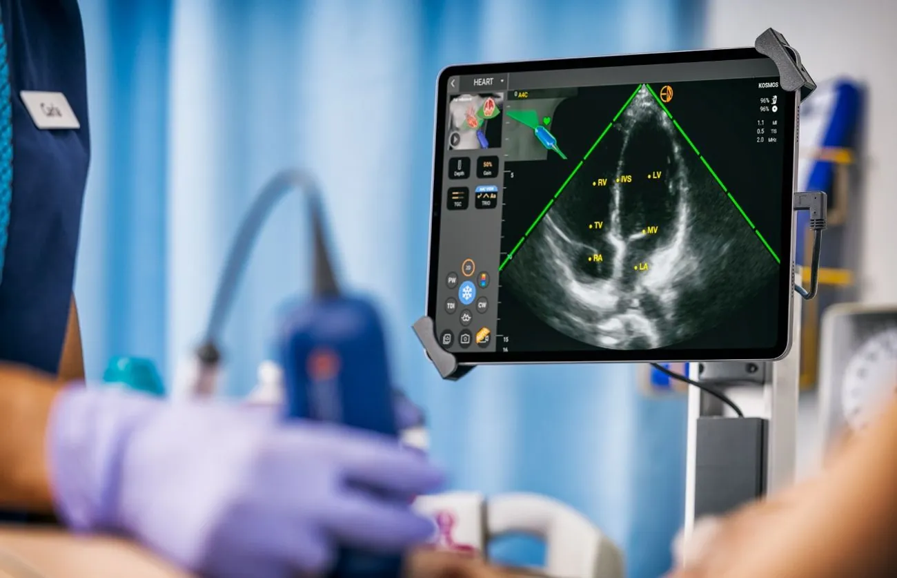 Samsung планує інвестувати 100 мільйонів у стартап Exo Imaging, що революціонізує медицину Samsung планує інвестувати 100 мільйонів у стартап Exo Imaging, що революціонізує медицину