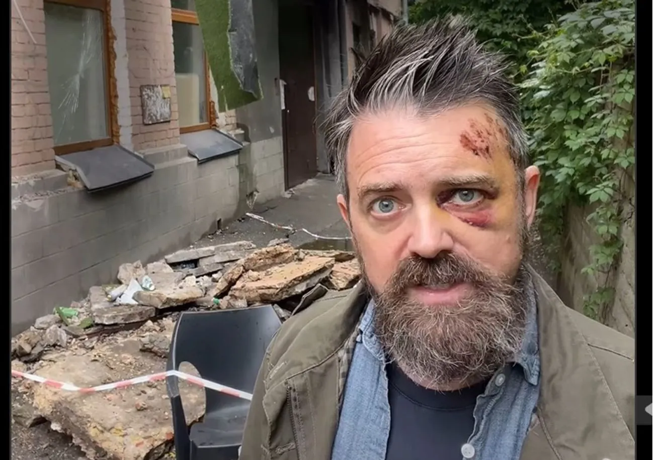 В Подільському районі на американця впав балкон перед входом в підʼїзд багатоквартирного будинку - КМВА 