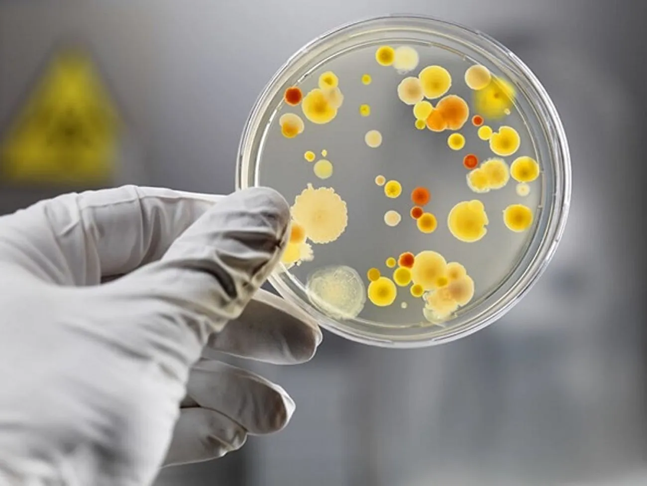 Sanitary control and epidemiological supervision according to European standards or destruction of the existing system: about reservations to the deputy initiative Sanitary control and epidemiological supervision according to European standards or destruction of the existing system: about reservations to the deputy initiative